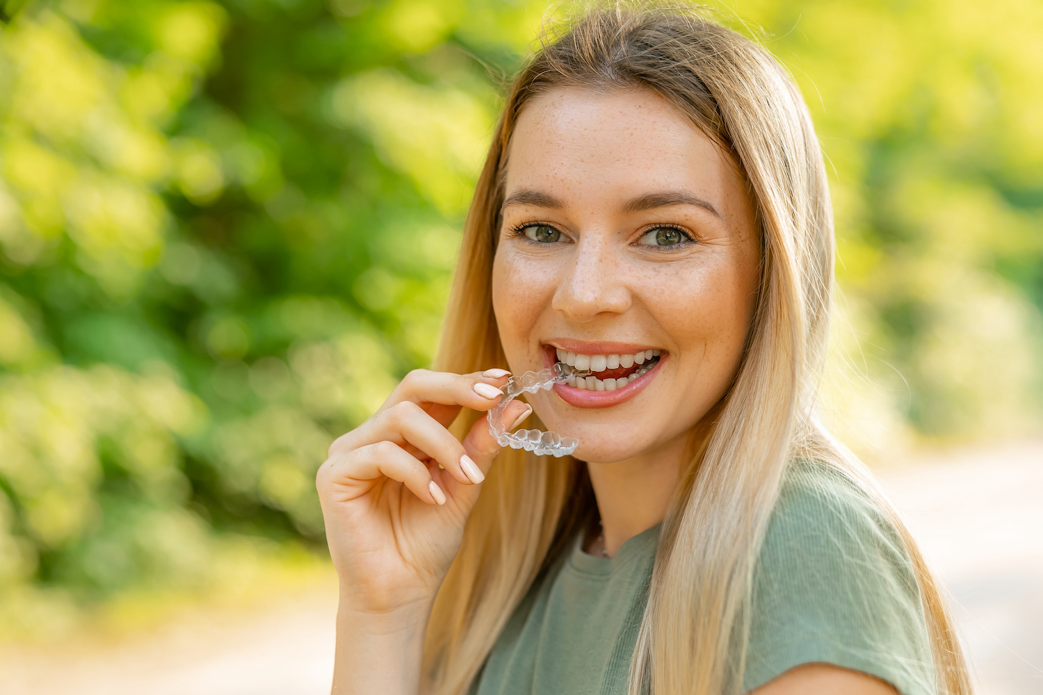Invisalign in North Wales and Chester