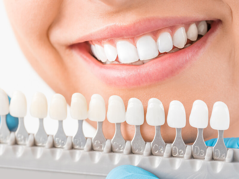 Greenacre Orthodontics Teeth Whitening CTA